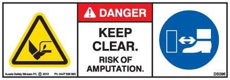 FOOT AMPUTATION (Horizontal)